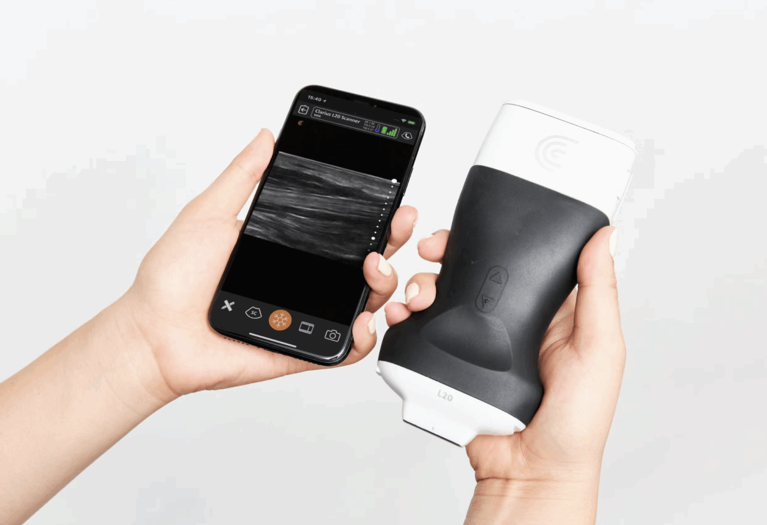 Clarius เทคโนโลยีเครื่องอัลตราซาวด์ไร้สายที่พลิกโฉมวงการแพทย์ยุคใหม่