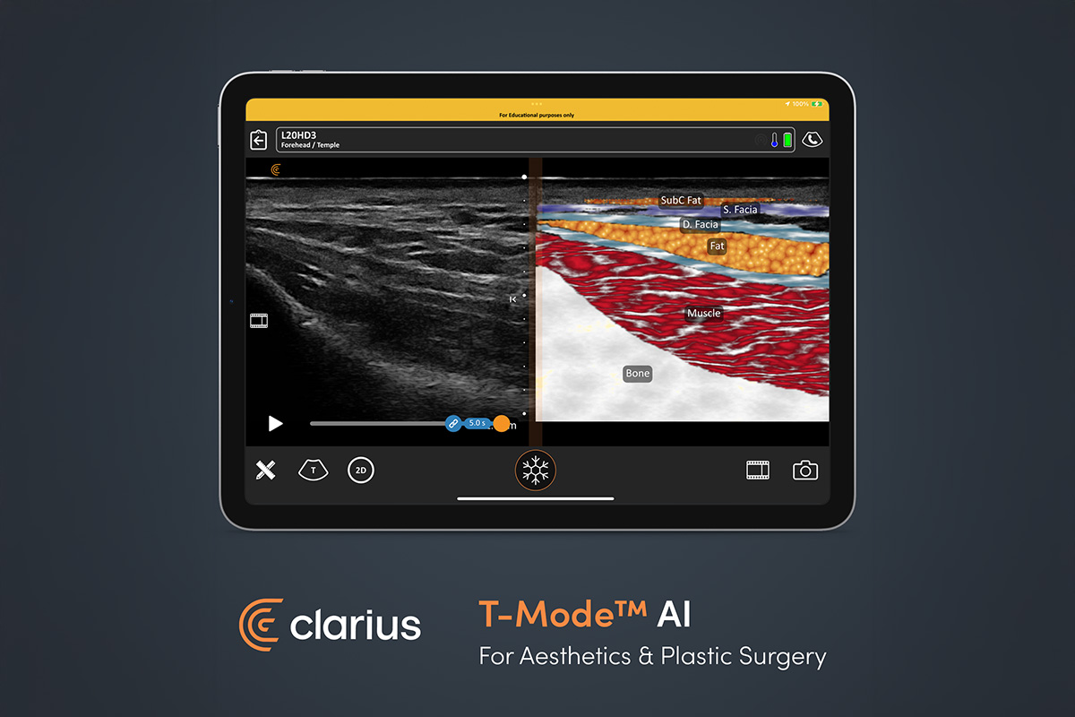 จุดเด่นของ Clarius Ultrasound