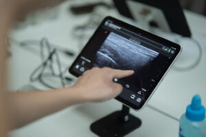 Clarius Workshop&Hand On