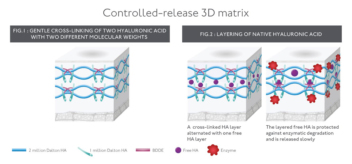 กลไกการทำงาน MATRICYAL 3D TECHNOLOGY